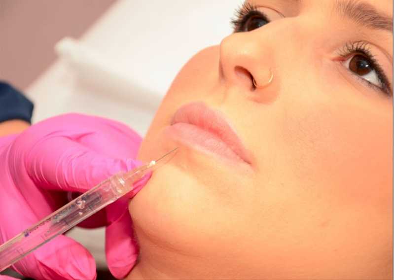 Aplicação Botox Clínica Setor Crimeia Oeste - Aplicação de Botox no Rosto