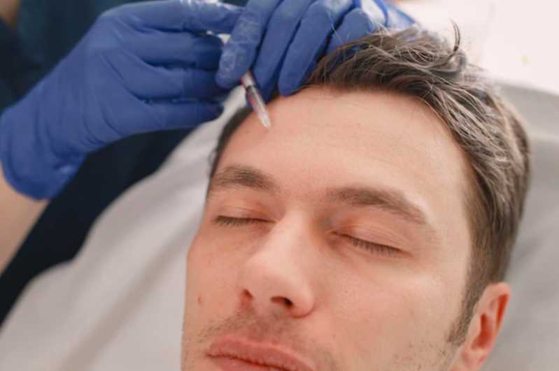 Aplicação de Botox em Homens Vila Canaã - Aplicação de Botox Facial