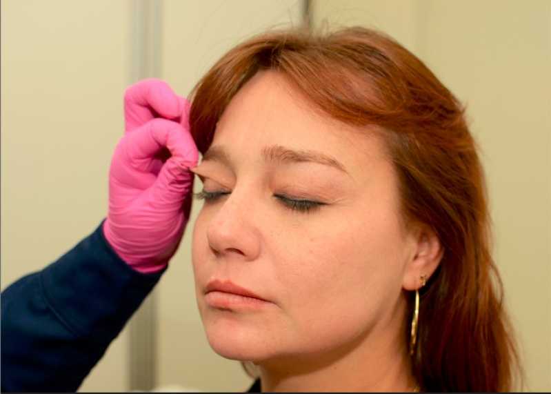 Aplicação de Botox Facial Clínica Residencial Nossa Morada - Aplicação de Botox para Sudorese