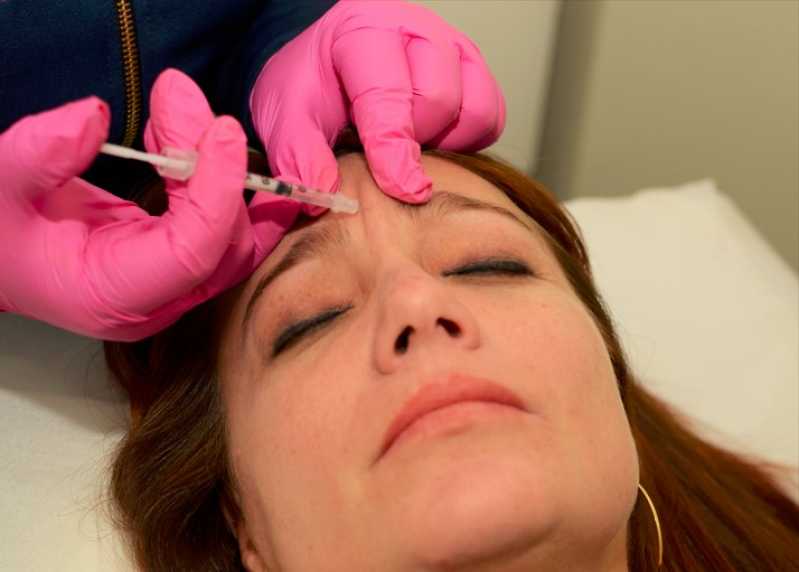 Aplicação de Botox no Rosto Clínica Vila Megale - Aplicação de Botox na Testa