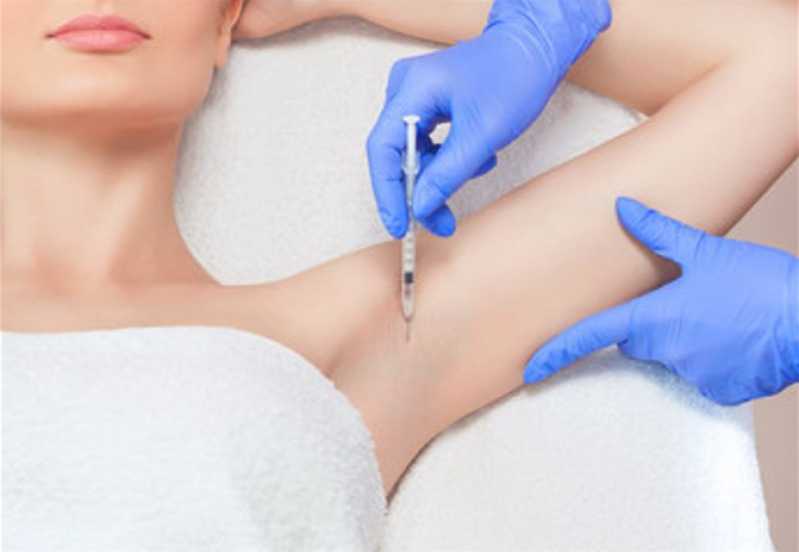 Aplicação de Botox para Sudorese Vila Santa Rita - 5ª Etapa - Aplicação de Botox nos Lábios