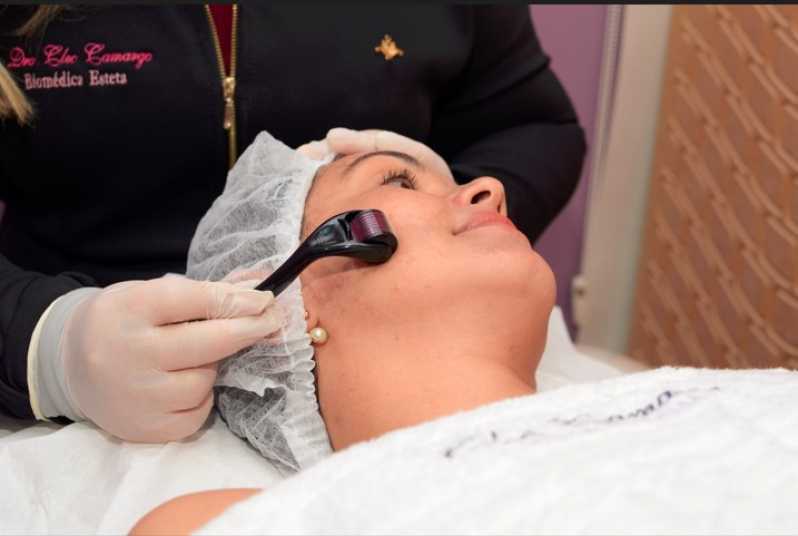 Clínica Especializada em Microagulhamento Facial Goianira - Microagulhamento para Poros Dilatados