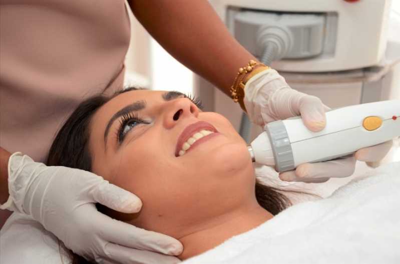 Onde Fazer Tratamento Facial Vila Romana - Tratamento de Rejuvenescimento Facial
