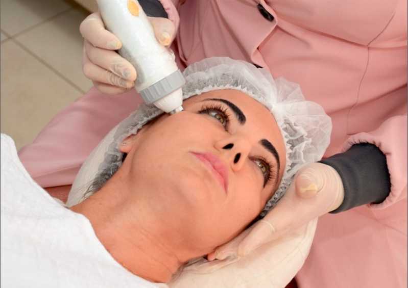 Onde Fazer Tratamento Flacidez Facial Vila Martins Extensão - Tratamento para Flacidez Facial