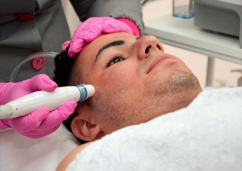 Onde Tem Peeling Facial Setor Urias Magalhães - Peeling Facial Limpeza de Pele
