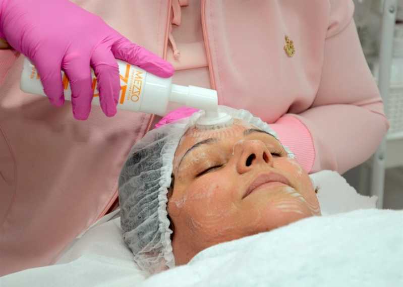 Peeling Facial Clínica Setor Marista - Peeling de água
