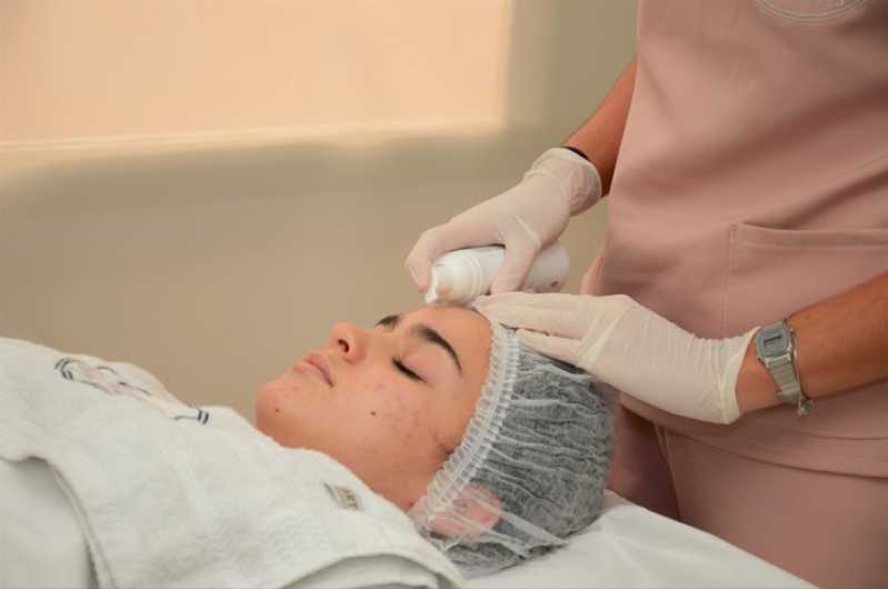 Peeling Facial de Diamante Profissional Clínica Vila Maria Dilce - Peeling Facial Químico