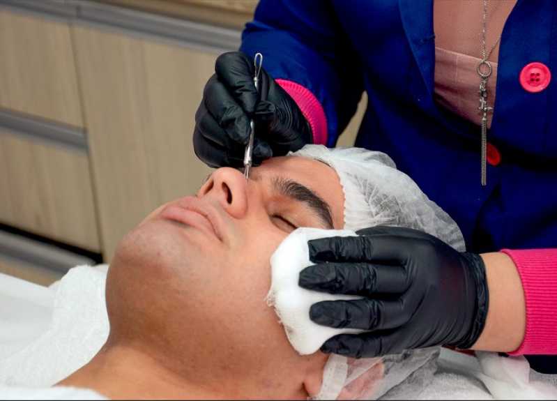 Peeling Facial Limpeza de Pele Clínica Vila Legionárias - Peeling Facial Químico com Caviar
