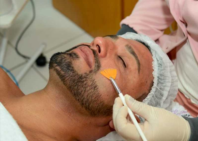 Peeling Facial Químico com Caviar Clínica Vila Maria Dilce - Peeling Facial Goiás