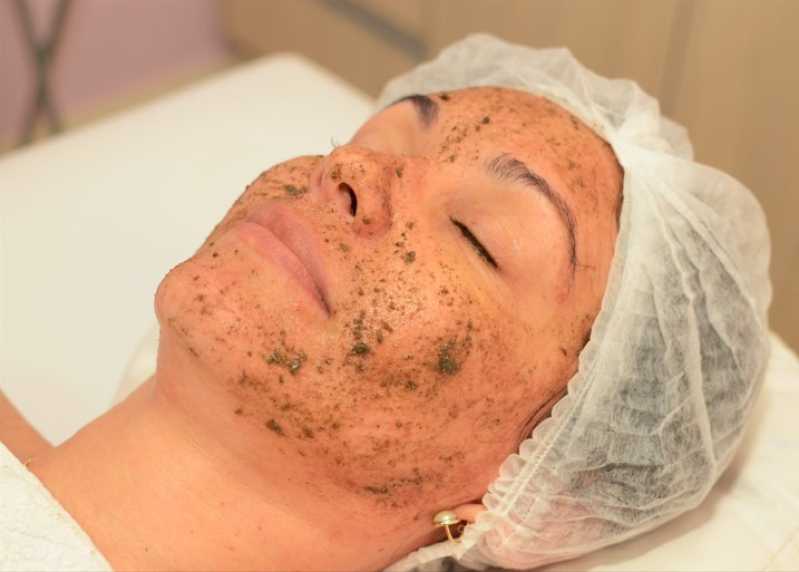 Peeling Facial Químico com Rose de Mer Vila Alvorada - Peeling Facial de Cristal
