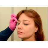 aplicação de botox facial clínica Setor Garavelo