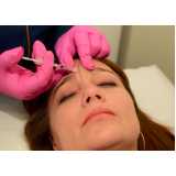 aplicação de botox no rosto clínica Industrial Santo Antônio