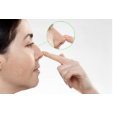 clínica especializada em ácido hialurônico para nariz Setor Faicalville