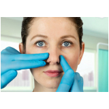 clínica especializada em preenchimento do nariz com ácido hialurônico Vila dos Alpes
