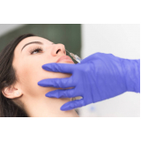 clínica especializada em preenchimento no nariz com ácido hialurônico Vila Santo Afonso