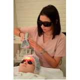 onde fazer tratamento facial a laser Vila Matilde