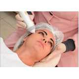 onde fazer tratamento para flacidez facial Setor Tancredo Neves