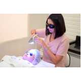 tratamento facial a laser Setor Crimeia Oeste