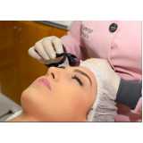 tratamento facial com plasma Vila Maria Dilce