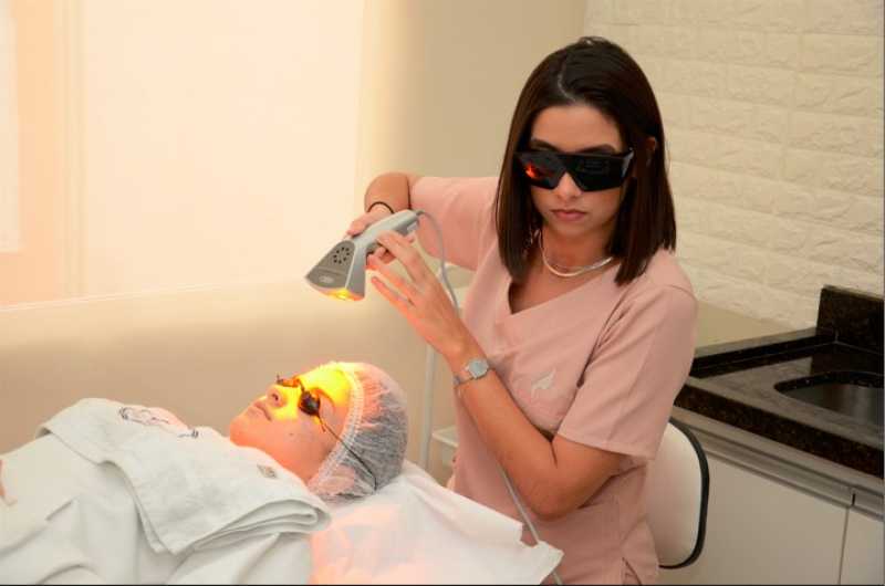 Tratamento Facial a Laser Agendar Vila Rizzo - Tratamento para Harmonização Facial