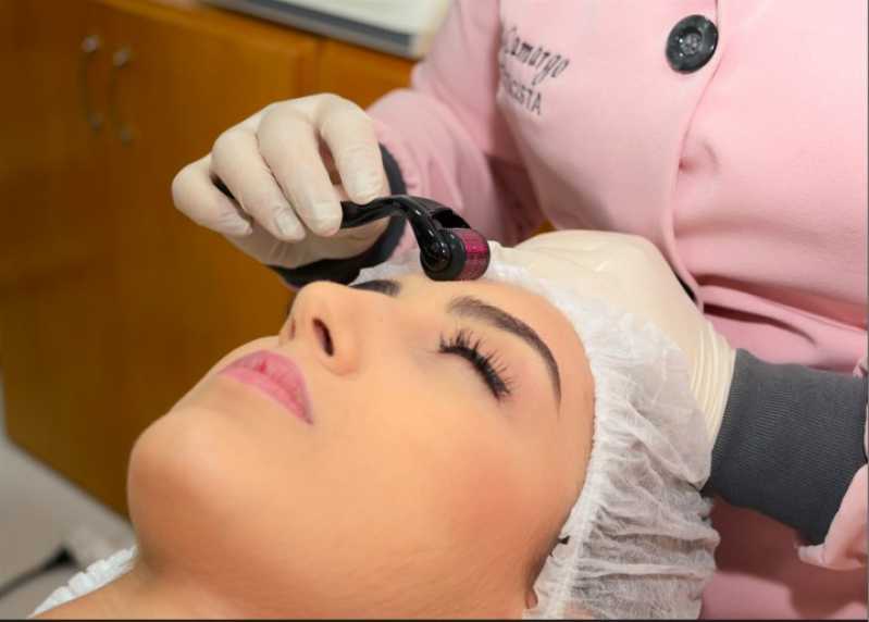 Tratamento Facial com Plasma Vila Mooca - Tratamento Facial