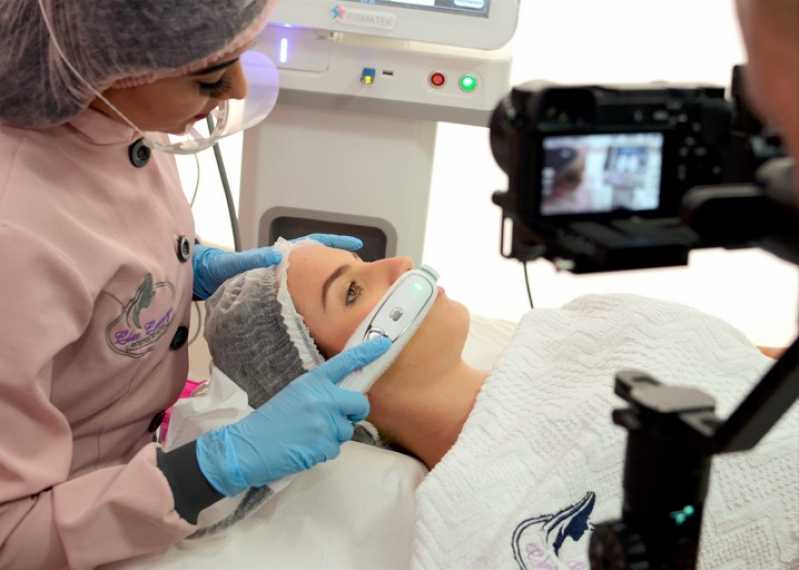 Ultrassom Microfocado Lifting Não Cirúrgico Parque Balneário - Ultrassom Microfocado Facial